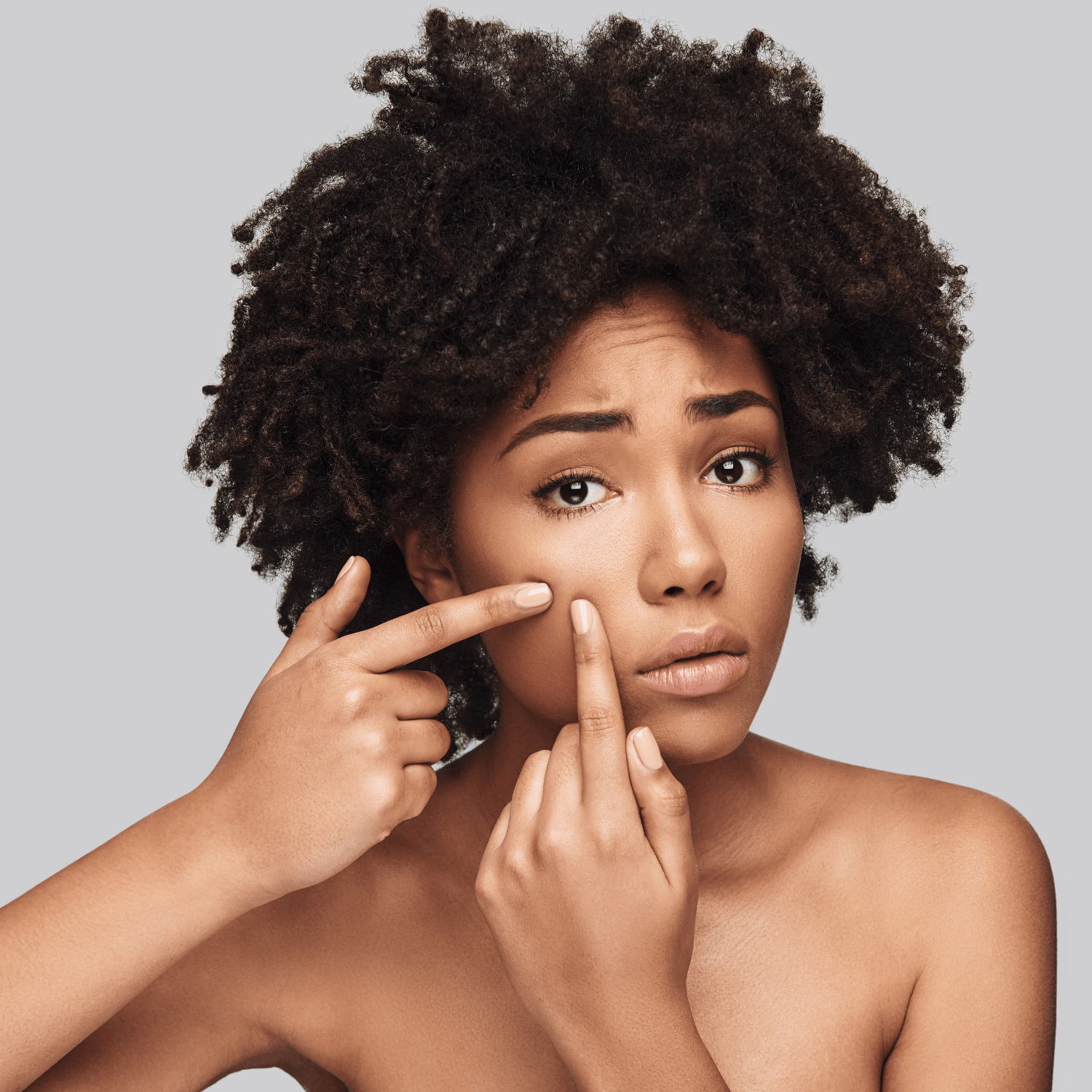 Best Herbs to Treat Acne: Effective Herbal Treatments and Products