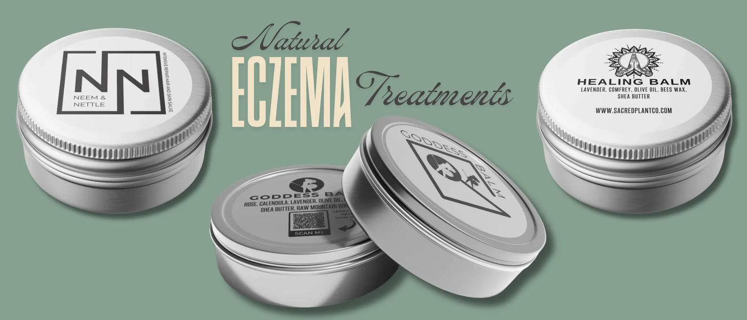 Natural eczema treatments hero image